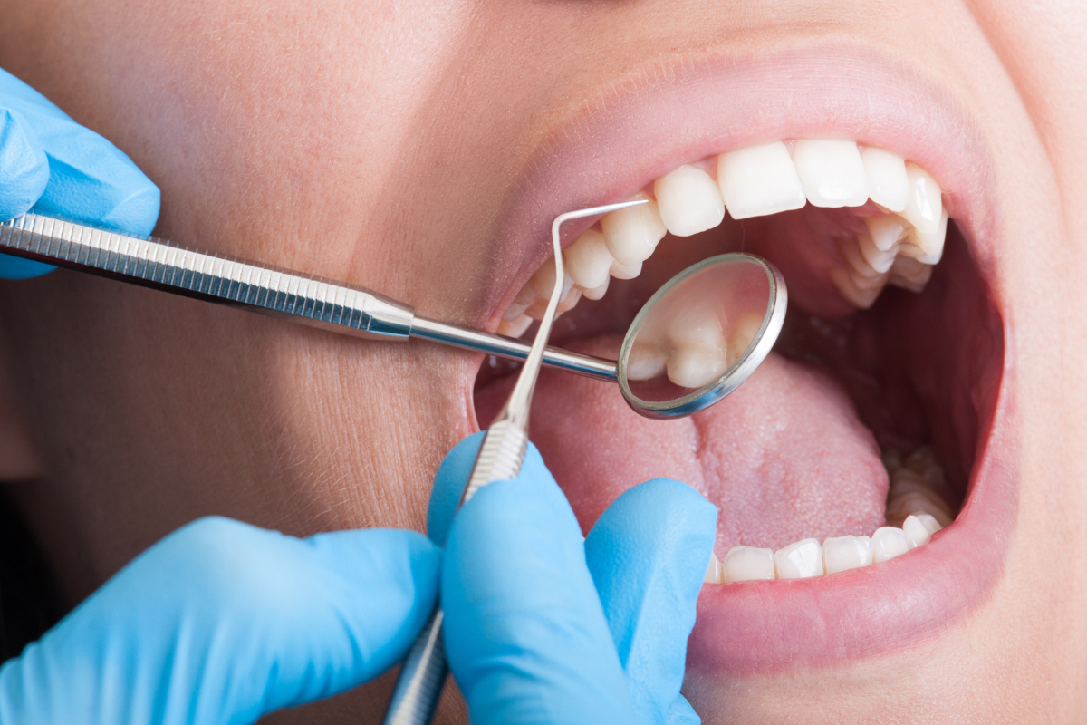 What is Cosmetic Bonding Fixing Chips, Gaps, and Stains Effectively Dentist examining patient's teeth during cosmetic bonding consultation in Bixby, OK.