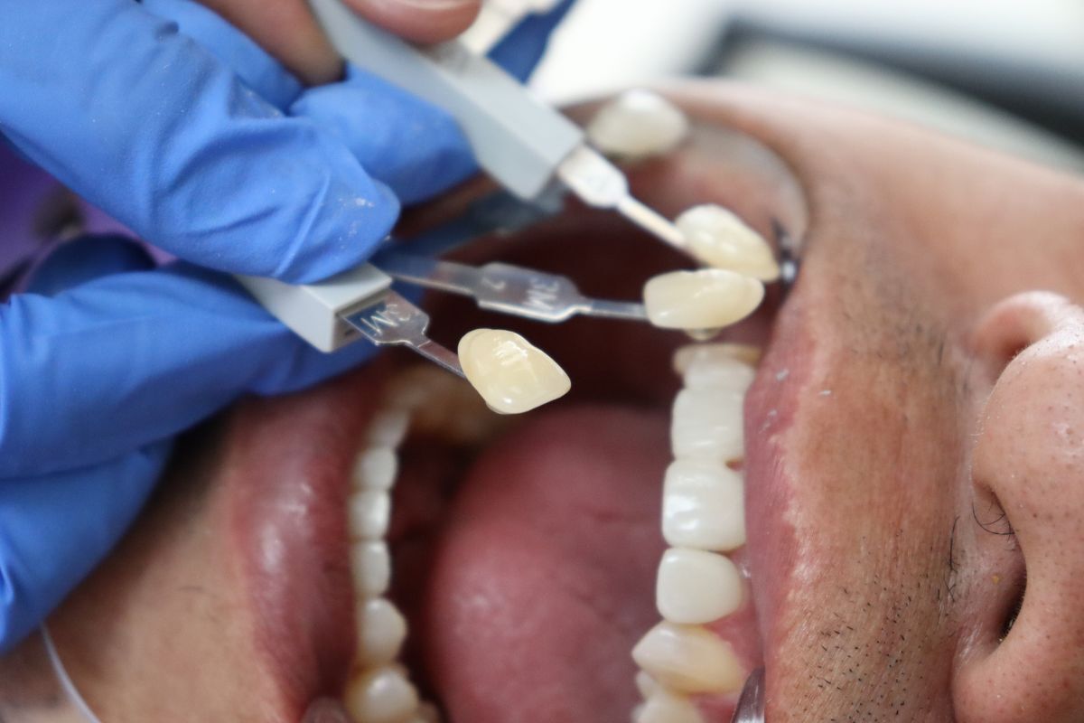 Dentist examining dental veneers on patient's teeth during cosmetic consultation.