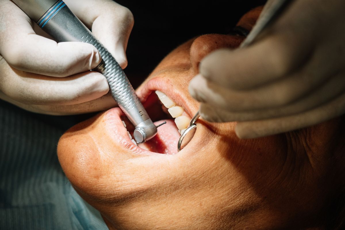 Dentist performing dental scaling and cleaning on patient's teeth during professional dental treatment.