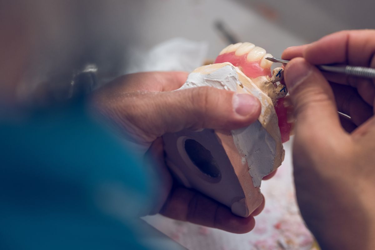 Dental professional demonstrating bone graft material on anatomical model for patient education.