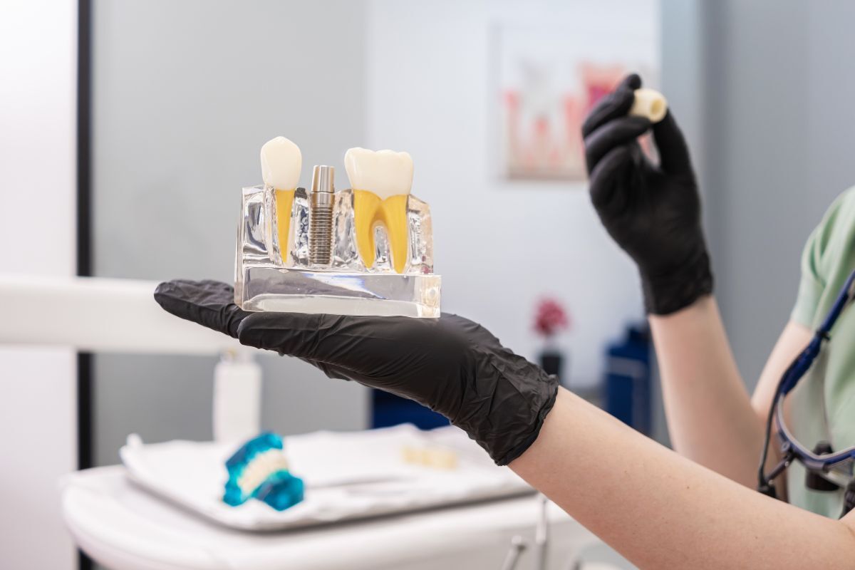 Dental professional holding dental implant model showing tooth replacement components and screw.