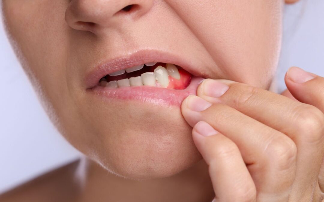 The Link Between Gum Health and Overall Wellness