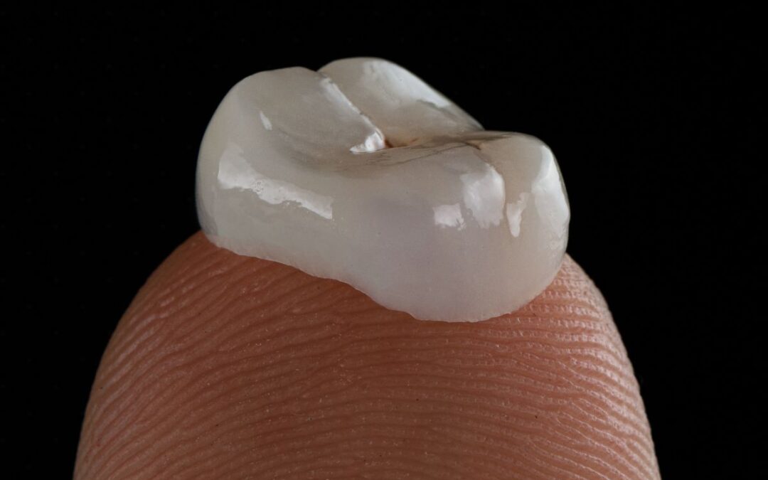 What Should You Do If Your Dental Crown Falls Out?