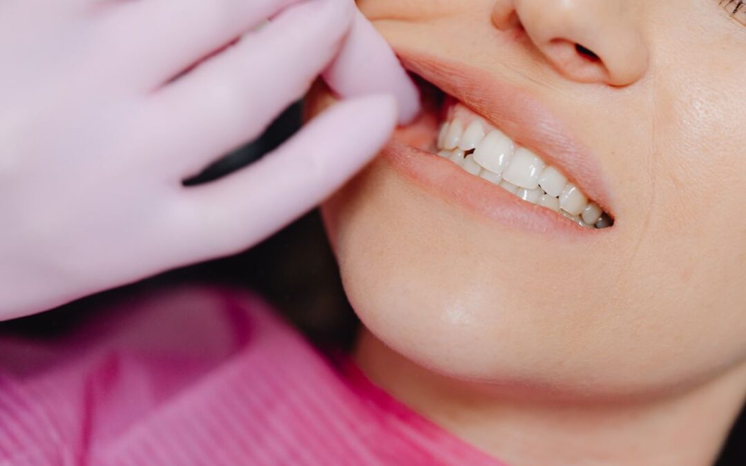 What Causes a Tooth Abscess, and How Is It Treated?