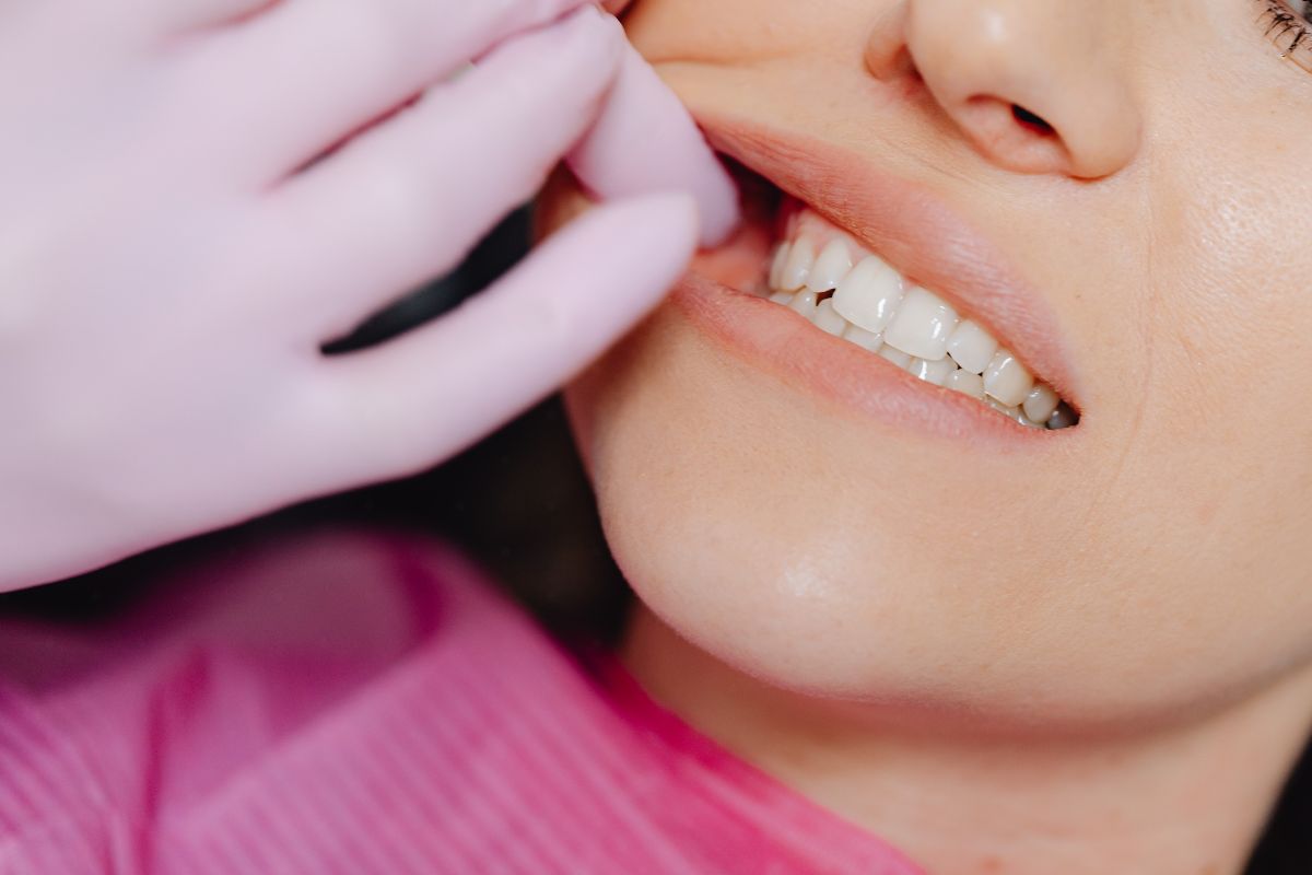 Tooth Abscess Treatment: Causes, Symptoms, and Care infected tooth root showing an abscess